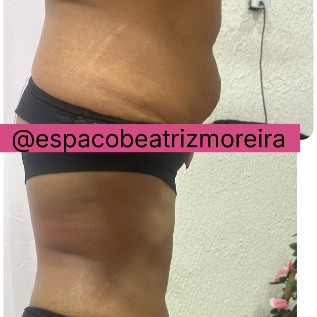 Beatriz Moreira da Silva, Massagem, foto 1 de 2