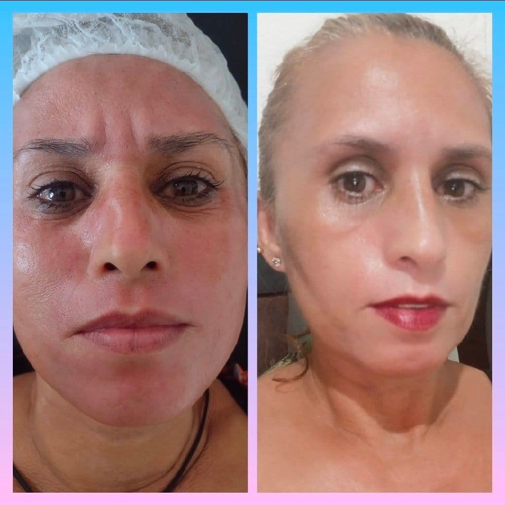 Emilene Florêncio, Massagem, foto 2 de 3