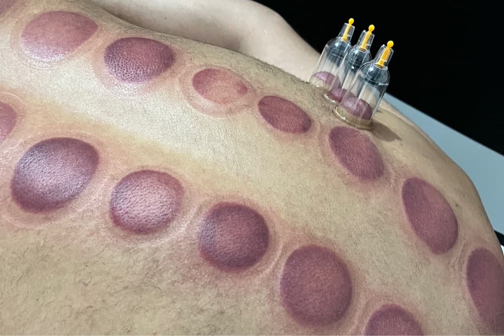 Massoterapeuta, Massagem, foto 1 de 3