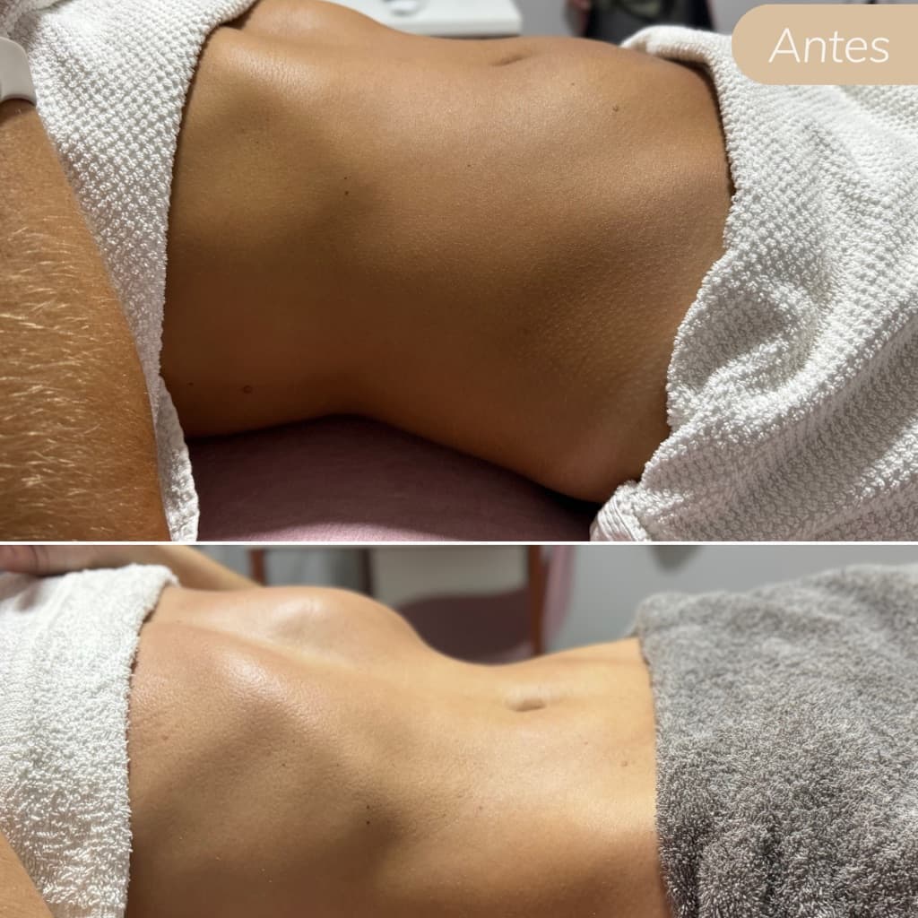 Victoria Martins Estética, Massagem, foto 1 de 2