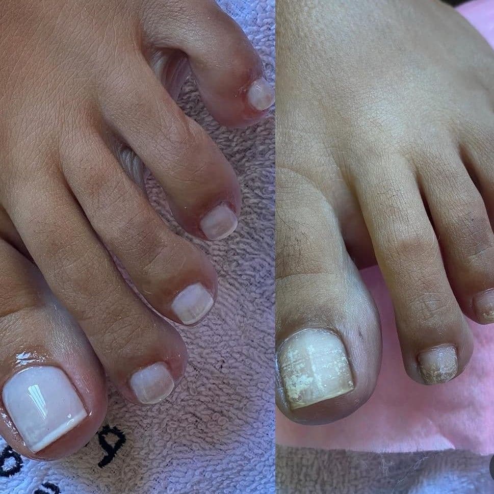 Esmalteria Da Teté, Unhas, foto 2 de 3